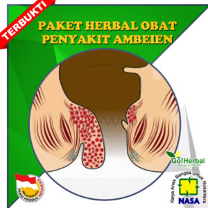 ambeien nasa