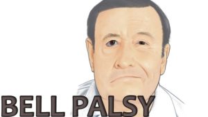 obat bells palsy