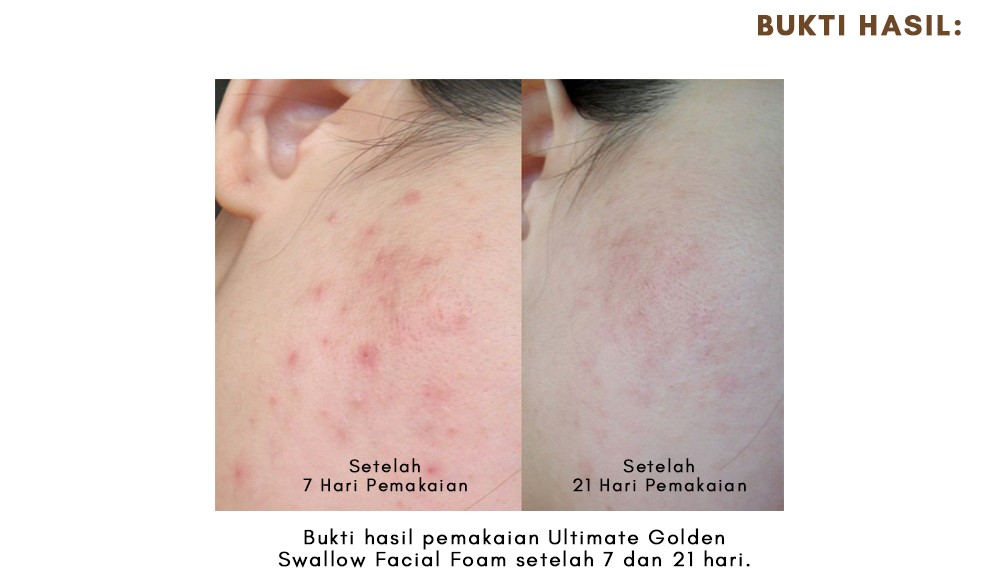 Lacoco Ultimate Golden Swallow Facial Foam
